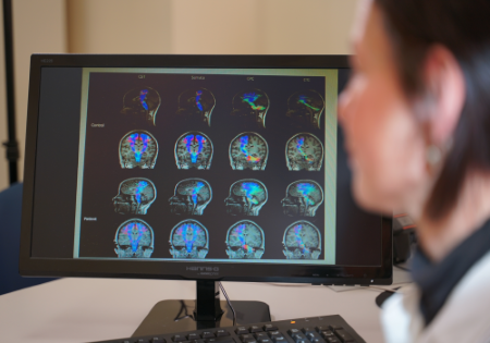 Sclerosi multipla: diagnostica per immagini