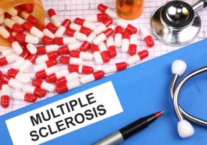Sclerosi multipla: le nuove frontiere dell’imaging e le terapie personalizzate