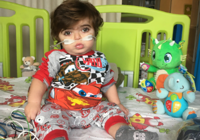 Mario con la sindrome CHOPS
