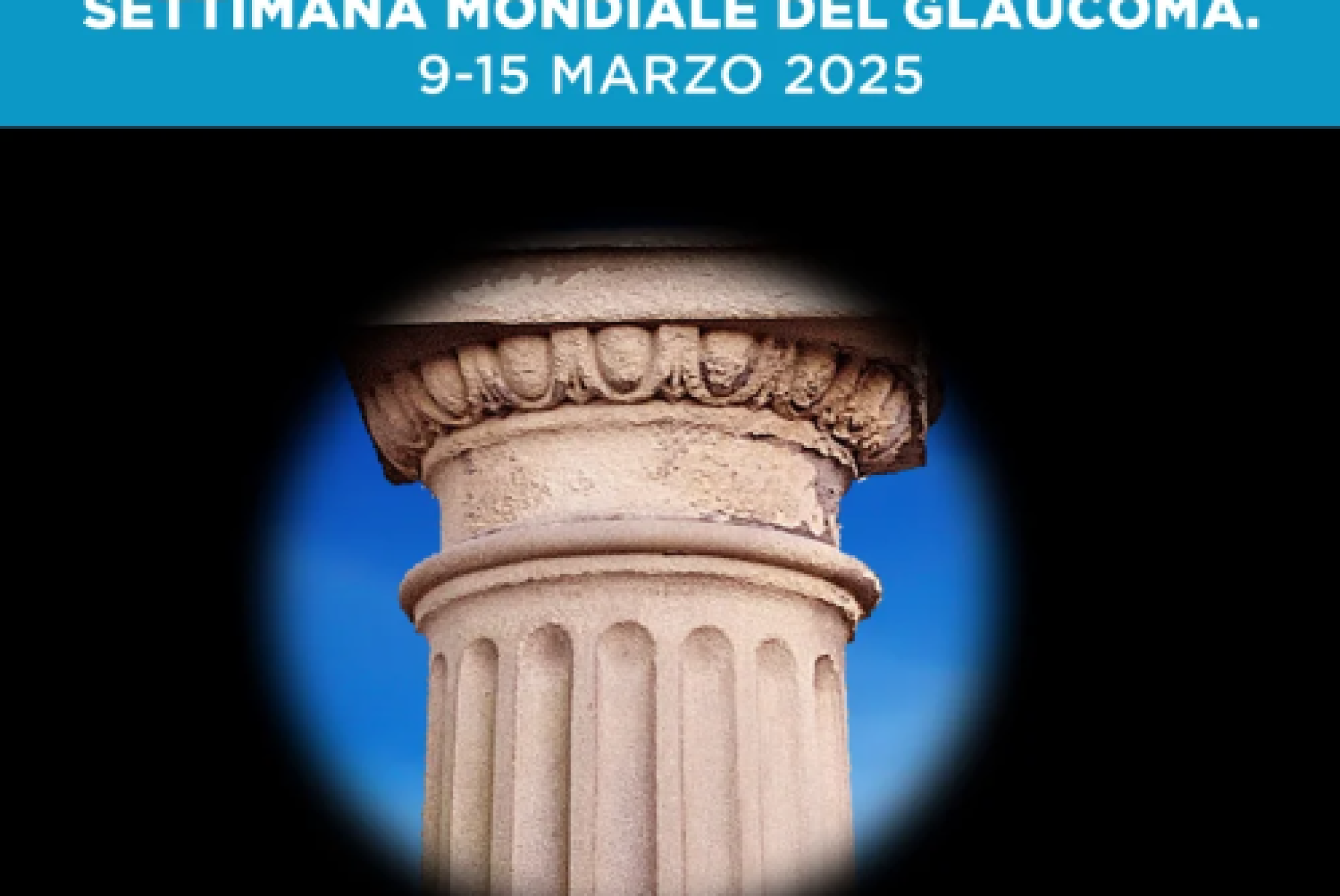 Non permettere ai tuoi occhi di perdere l’orientamento: previeni il glaucoma!